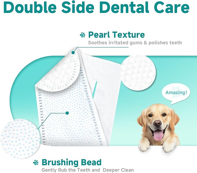Pet Dental Finger Wipes for Dogs & Cats, Dog Teeth Cleaning Wipes Tooth Brushing Kit by Remove Plaque and Tartar & Freshens Breath Buildup No-Rinse Dog Finger Toothbrush