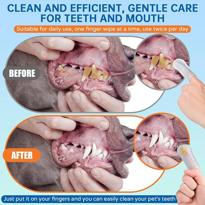 PET Teeth Cleaning Wipes for Dogs & Cats,Gentle Pet Dental Care Wipes with Massaging Micro-Brushing Beads, Remove Bad Breath & Plaque.Dog Toothbrush & Tooth Brushing Kit-Unscented